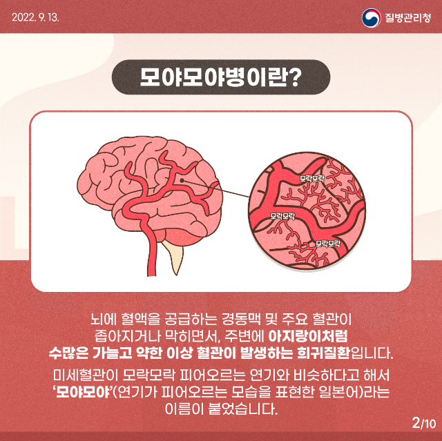 0913_[KDCA]모야모야병_카드뉴스 (2).png