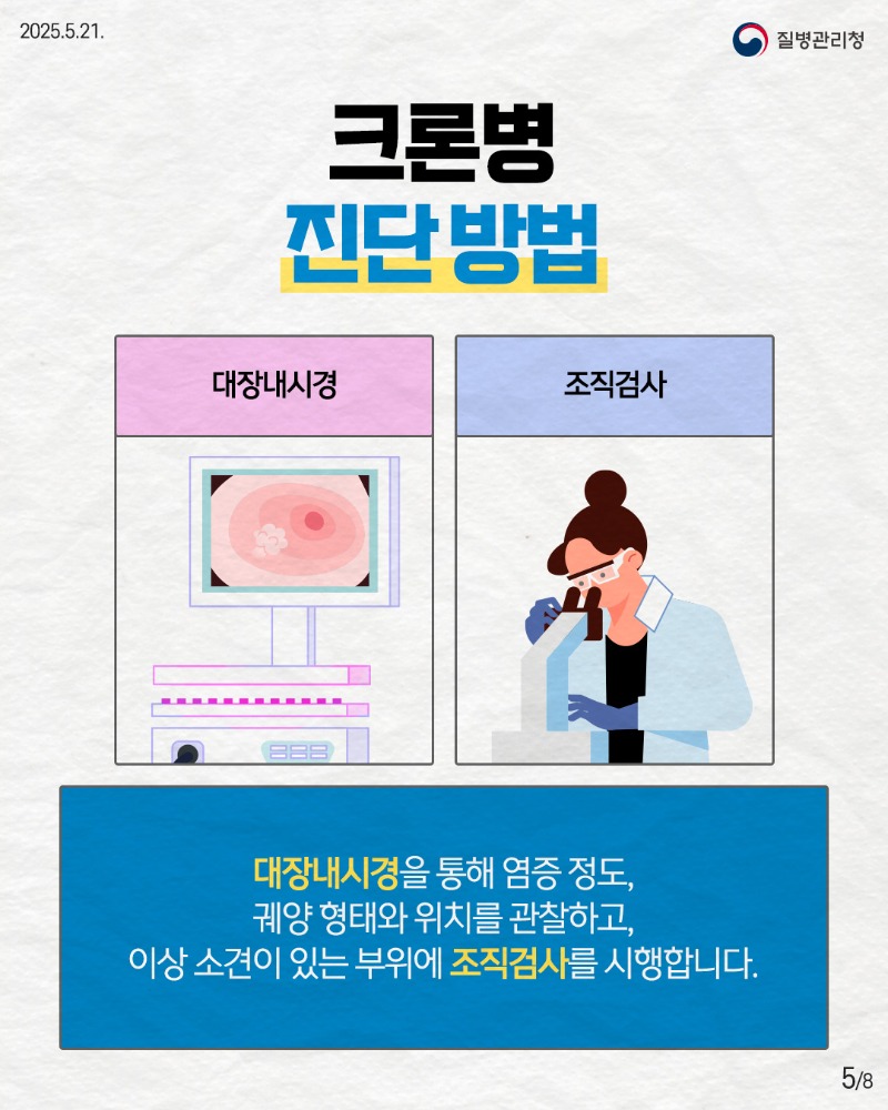 250520_희귀질환_크론병5.jpg