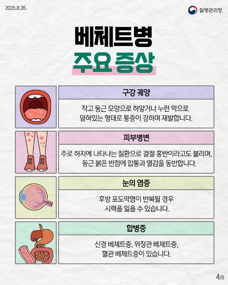 250825-희귀질환-베체트병4.jpg