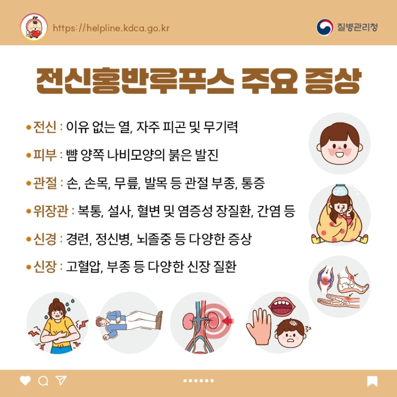 우리반 아이, 이런 병이 있다면_전신홍반루푸스_카드뉴스2.jpg